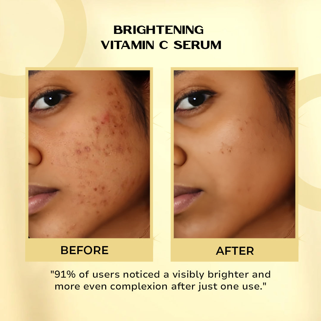 VITAMIN C SERUM