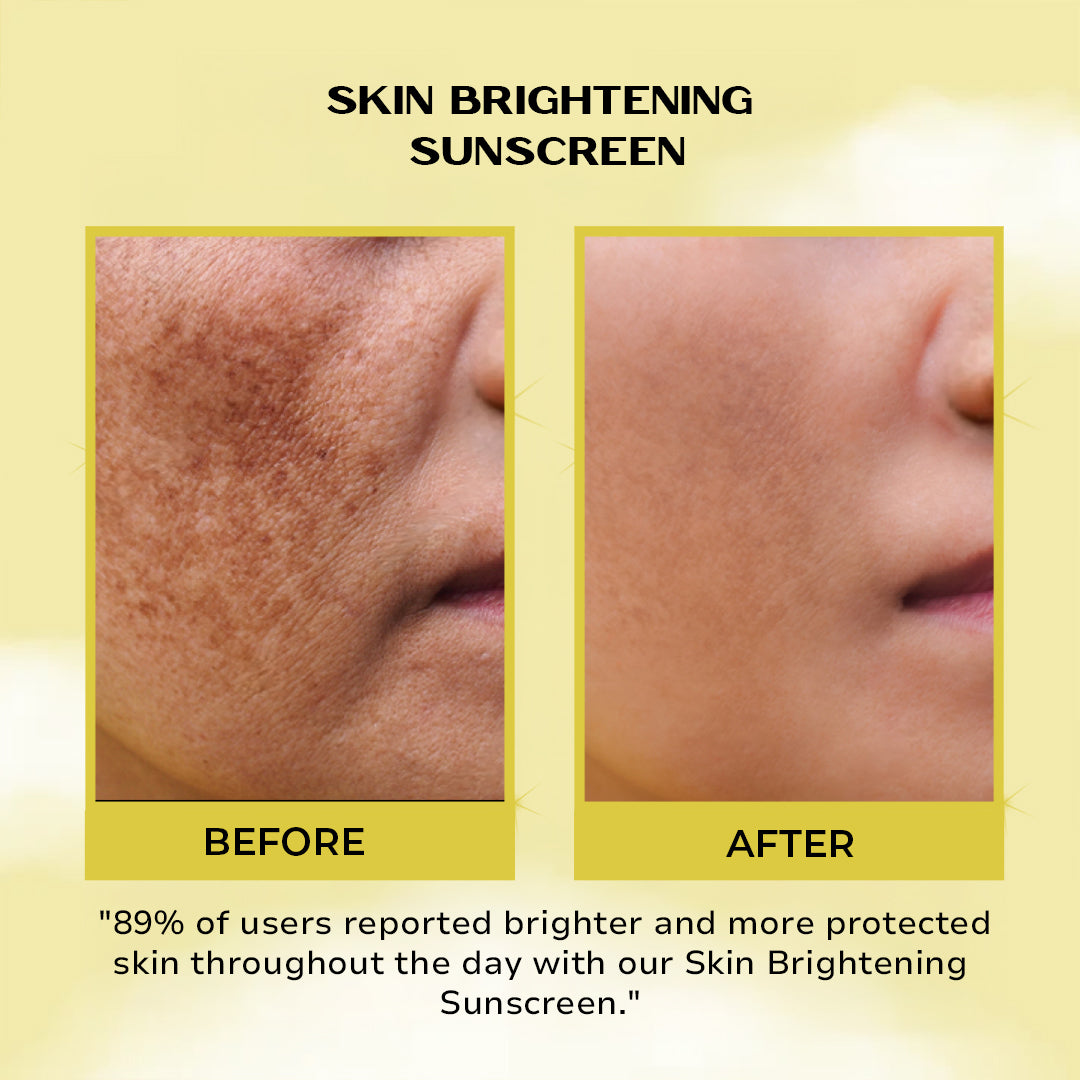 BRIGHTENING SUN DEFENCE